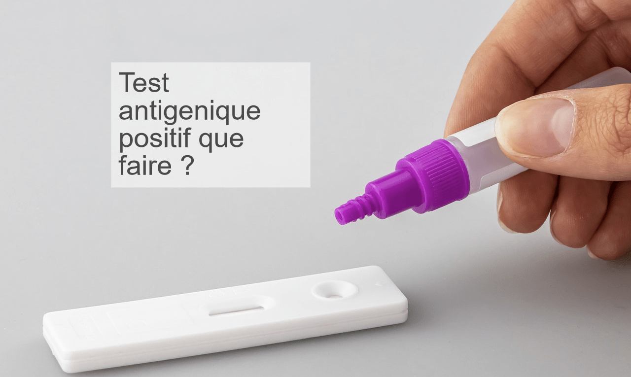 Test antigenique positif que faire ?